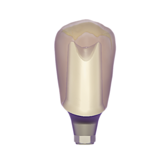 Custom Abutment